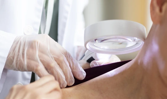 Enfermagem em Dermatologia