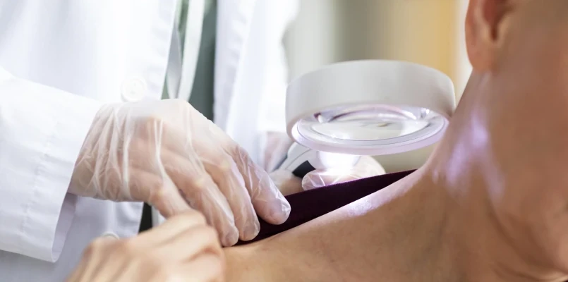 Enfermagem em Dermatologia